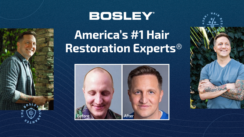 Bosley - Hair Restoration & Transplant - Chicago