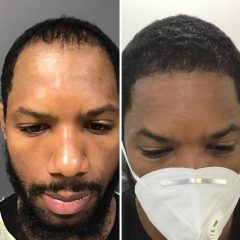 BioHair Restoration & Aesthetics