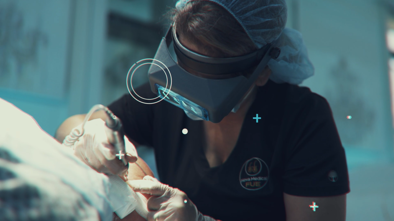 Nova Medical Hair Transplant Philadelphia